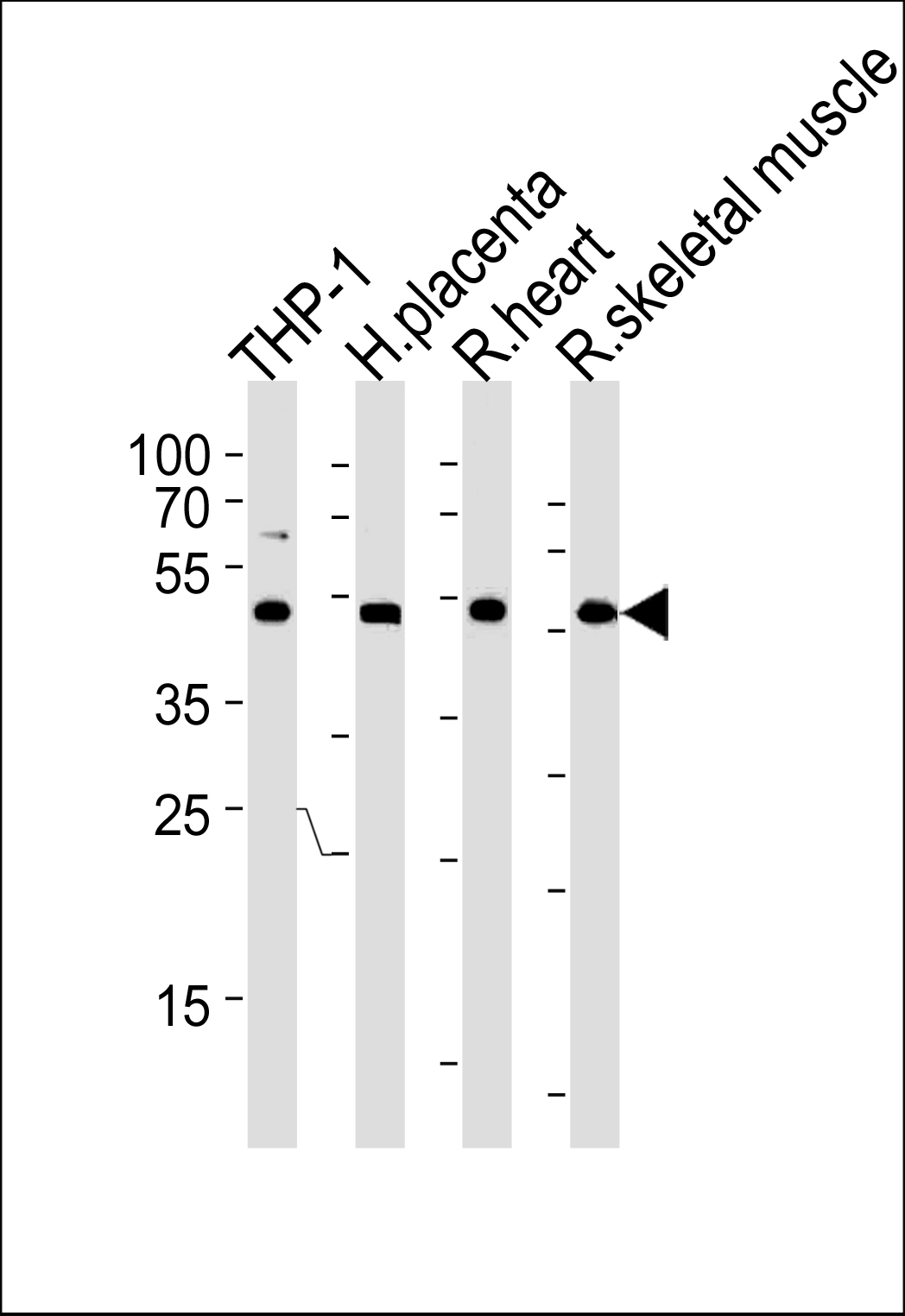 CIR (N-term)