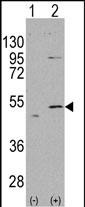 ALDH5A1 (N-term)