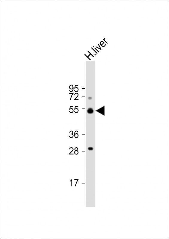 Rabbit Polyclonal Antibody to ALDH5A1 (N-term)