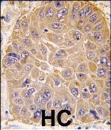 Rabbit Polyclonal Antibody to ALDH5A1 (N-term)