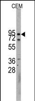 CDH10 (N-term)