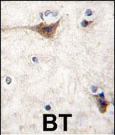 Rabbit Polyclonal Antibody to CDH10 (N-term)