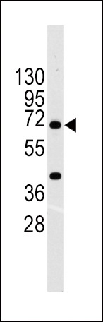 ABCG2 (BCRP)