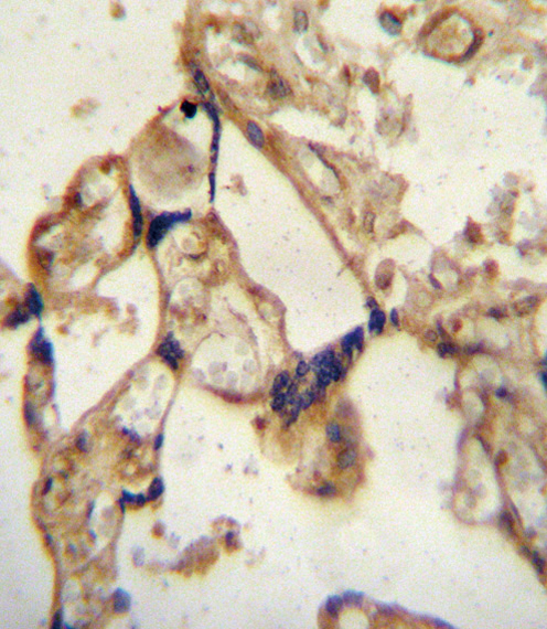 Rabbit Polyclonal Antibody to ABCG2 (BCRP)