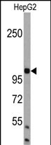 AMBRA1 (N-term)