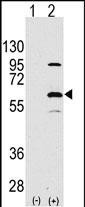 ELP3 (N-term)