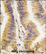 Rabbit Polyclonal Antibody to FRAT1