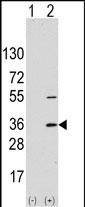 SSR1 (N-term)