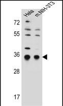 Rabbit Polyclonal Antibody to SSR1 (N-term)