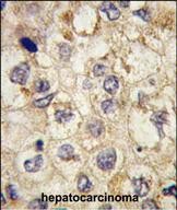 Rabbit Polyclonal Antibody to SSR1 (N-term)