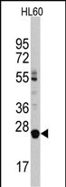 LIN28B