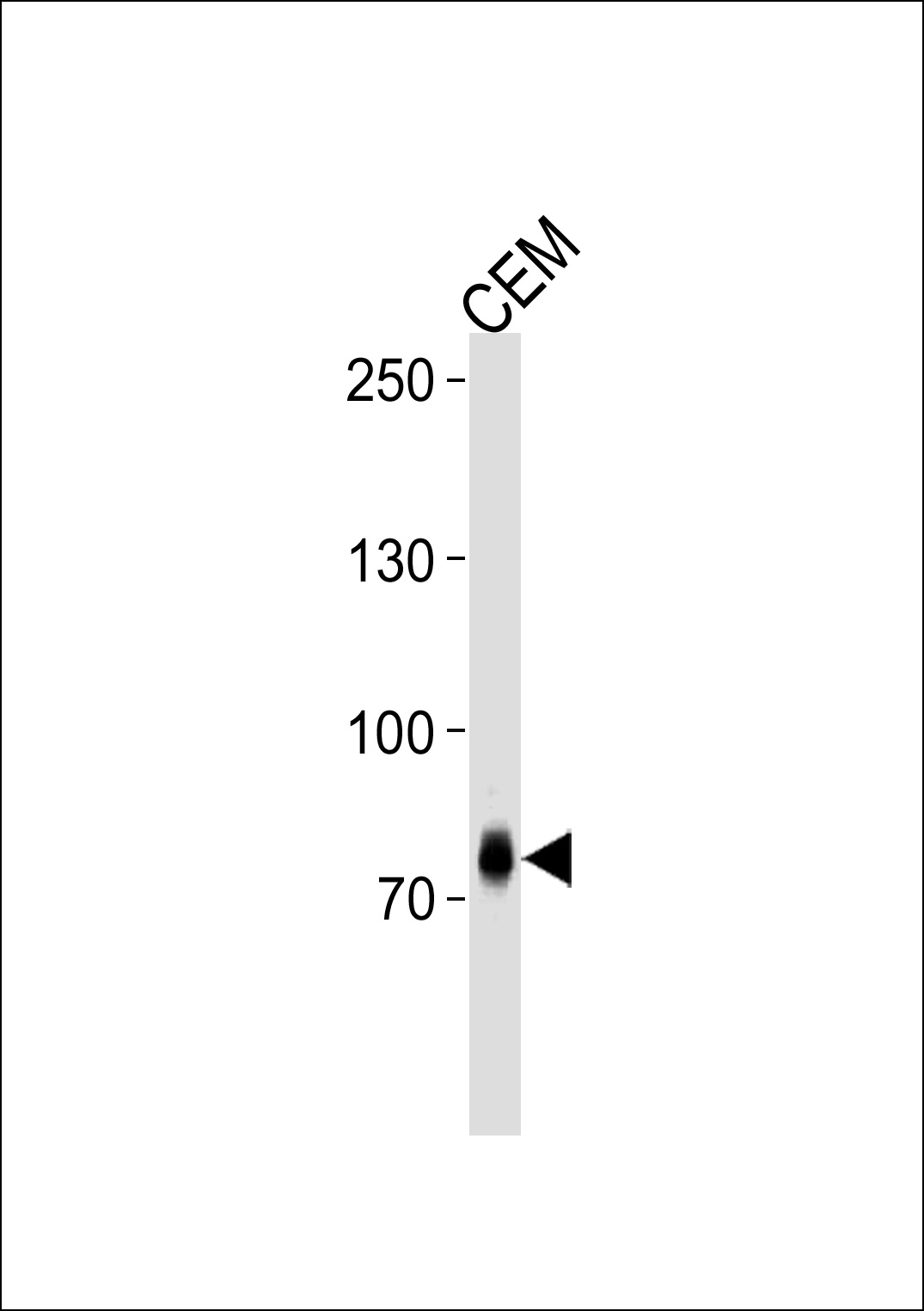 ZNF219