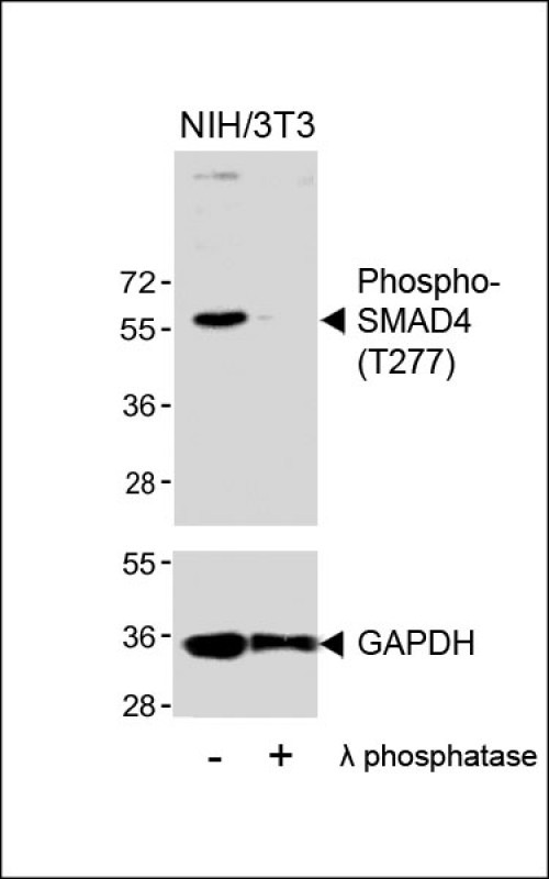 Rabbit Polyclonal Antibody to Phospho-SMAD4(T277)
