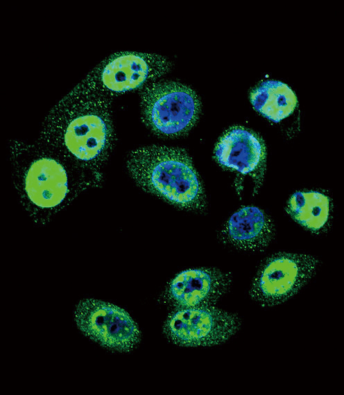 Rabbit Polyclonal Antibody to Phospho-SMAD4(T277)