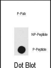 Phospho-DNA-PK(T2609)