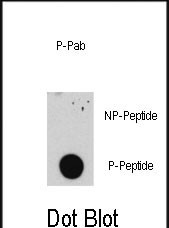 Phospho-E2F1(S332)