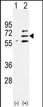 Parp6 (C-term 503)