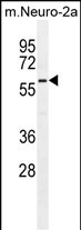 Rabbit Polyclonal Antibody to Parp6 (C-term 503)