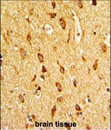 Rabbit Polyclonal Antibody to H Cadherin (CDH13) (N-term)