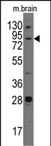 Junctophilin 3