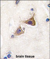 Rabbit Polyclonal Antibody to Junctophilin 3