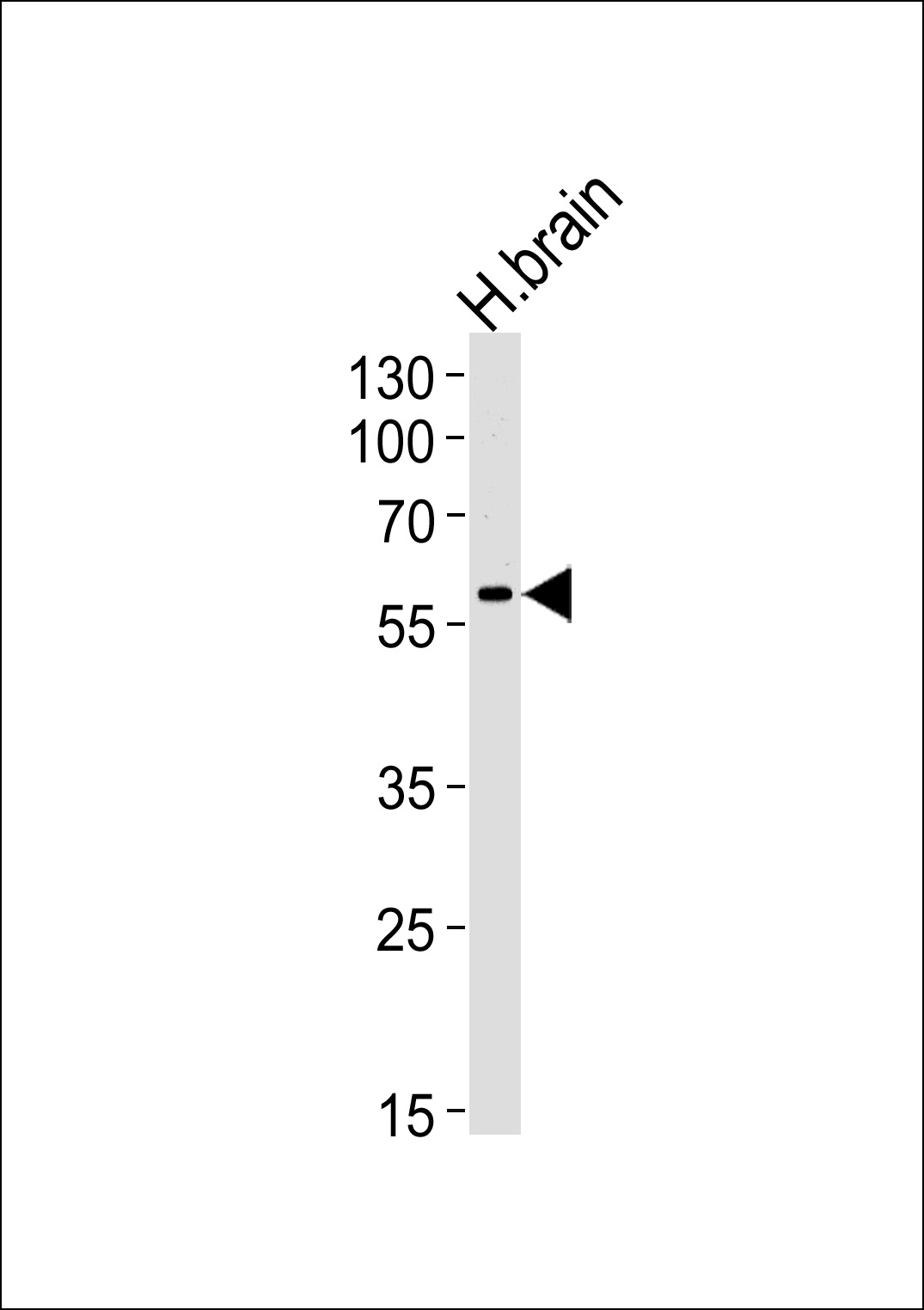HERV (ERVWE1)