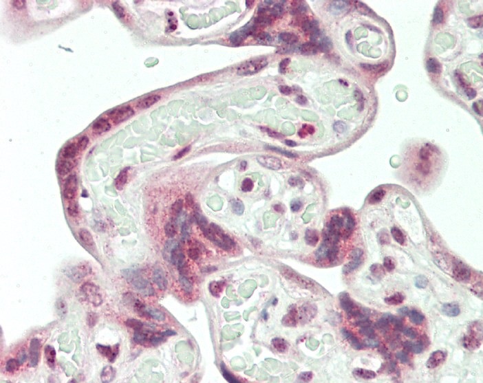 Rabbit Polyclonal Antibody to HERV (ERVWE1)