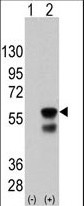 Mouse Monoclonal Antibody to PINK1