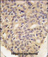 Mouse Monoclonal Antibody to PINK1