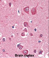 Mouse Monoclonal Antibody to PINK1