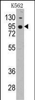 CDH7 (N-term)