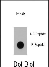 Phospho-Dnmt1(S714)