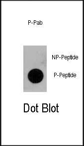 Phospho-CD133-pY828