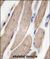 Rabbit Polyclonal Antibody to MAP2K5 (S149)