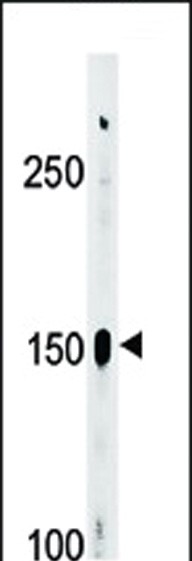 Rabbit Polyclonal Antibody to Phospho-ABL1(Y393)/ABL2(439)