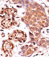 Rabbit Polyclonal Antibody to Phospho-ABL1(Y393)/ABL2(439)
