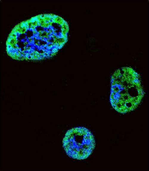 Rabbit Polyclonal Antibody to HDGF