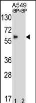 Rabbit Polyclonal Antibody to BBS4