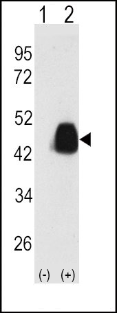 Rabbit Polyclonal Antibody to PDX1 (T11)