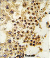 Rabbit Polyclonal Antibody to GDF3