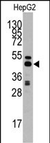 S adenosylhomocysteine hydrolase (ACHY)