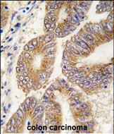Rabbit Polyclonal Antibody to S adenosylhomocysteine hydrolase (ACHY)