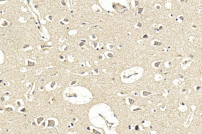 Rabbit Polyclonal Antibody to LGR5 (GPR49)