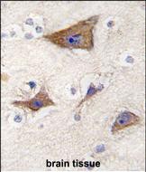 Rabbit Polyclonal Antibody to LGR5 (GPR49)