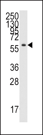 Tyrosyl tRNA synthetase (YARS)