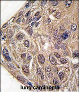 Rabbit Polyclonal Antibody to Tyrosyl tRNA synthetase (YARS)