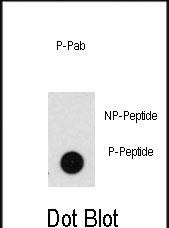 Phospho-PHB2(Y128)