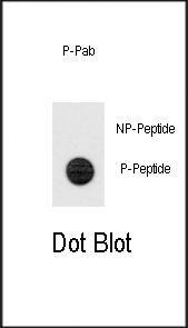 Phospho-TERT(S1125)