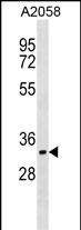 CDK5R1(p35)