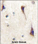 Rabbit Polyclonal Antibody to CDK5R1(p35)